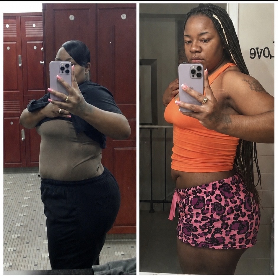 Client transformation: side-by-side before and after photos showing renewed strength, confidence, and body transformation